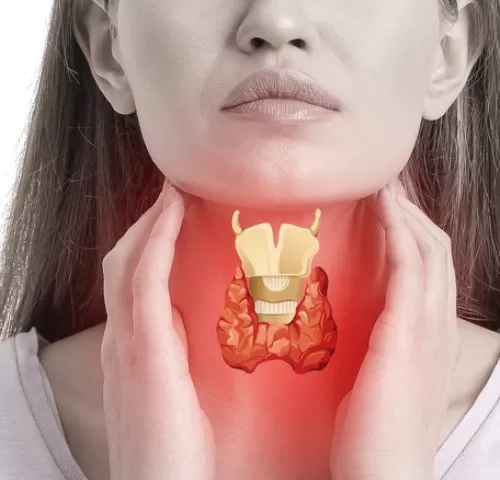 Woman,With,Thyroid,Gland,Problem,On,White,Background